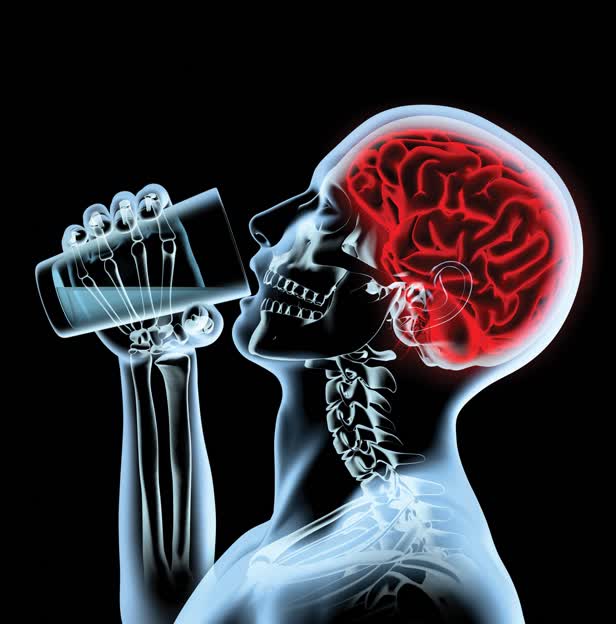X - ray brain