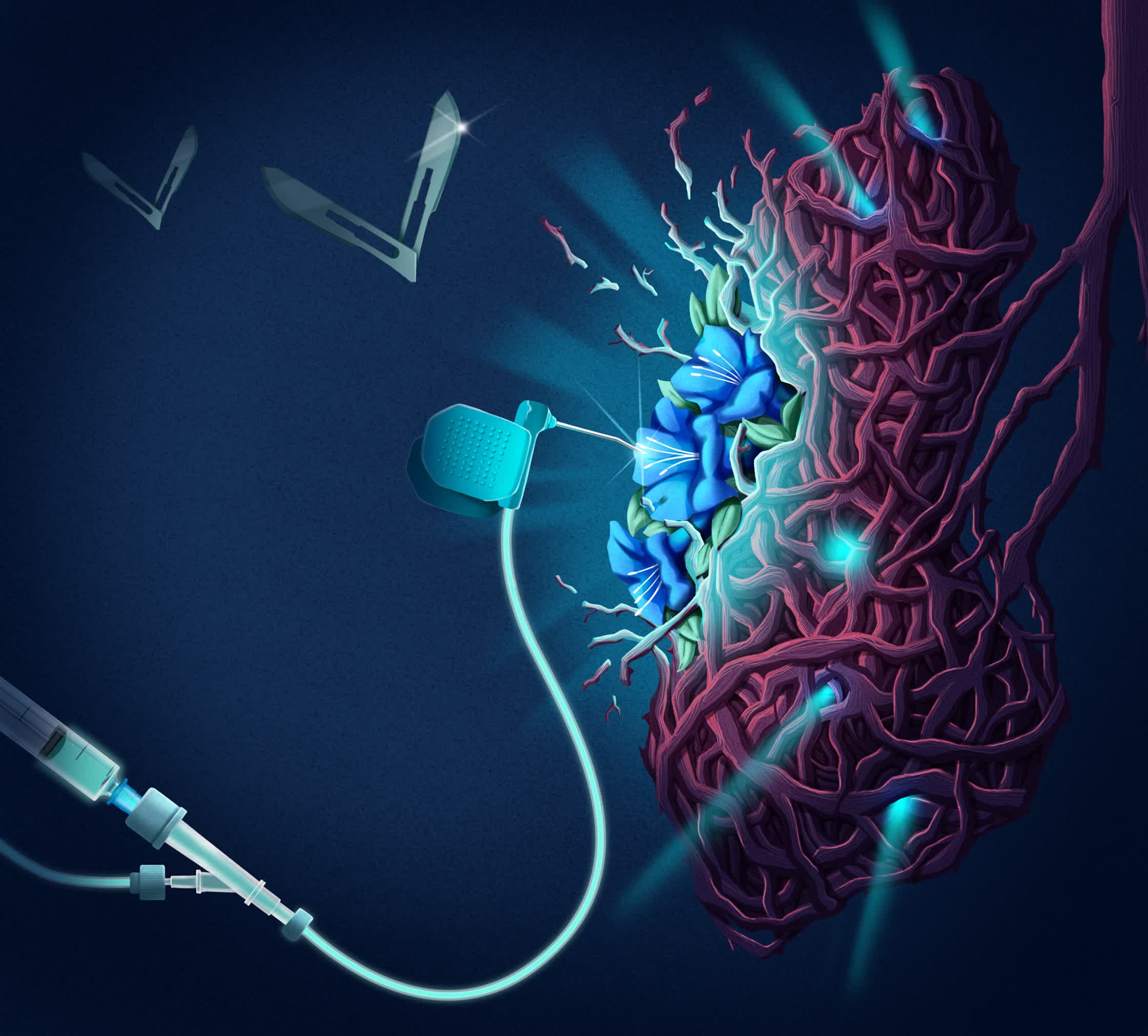 Pleurectomy_JuneCover_TheLancetRespiratoryMedicine.jpg