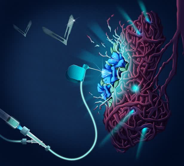 Pleurectomy June Cover / The Lancet Respiratory Medicine