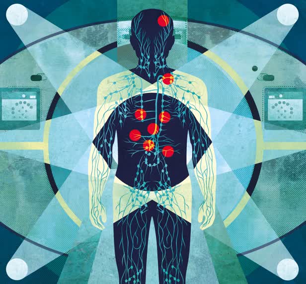 April 2017 / The Lancet Oncology