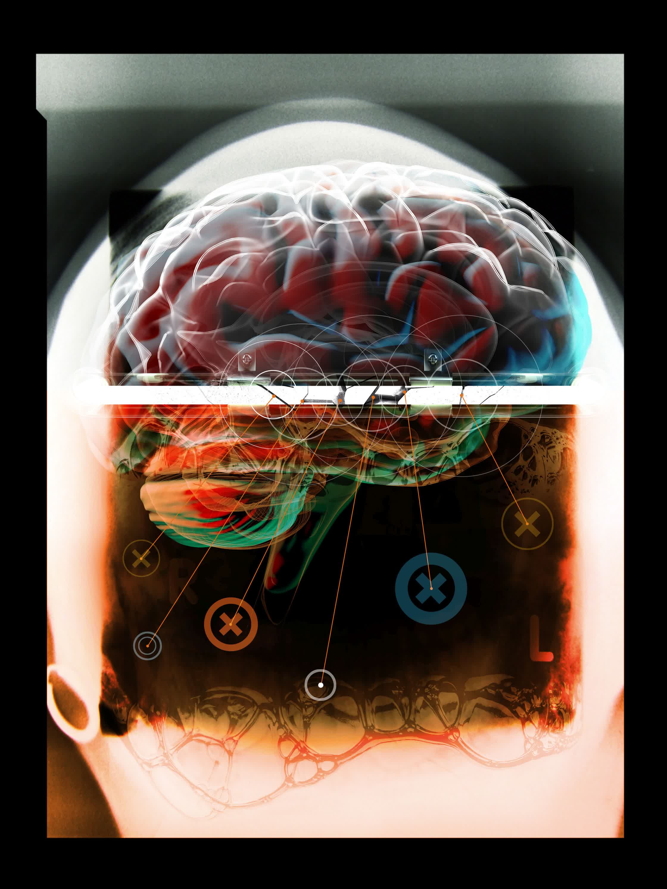 viktor_koen_Brain.jpg