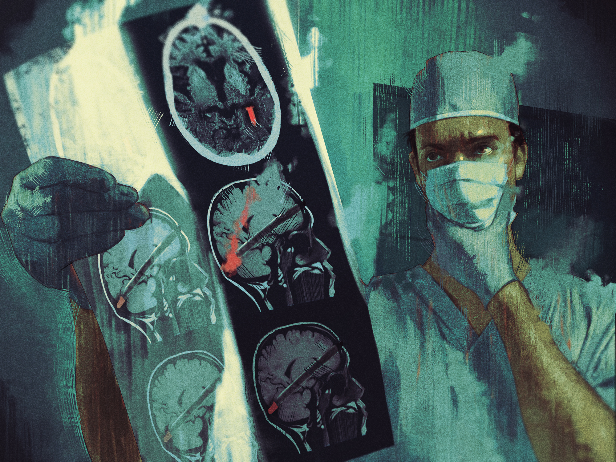 18_vice_magazine_bullet_brain_surgery.jpg